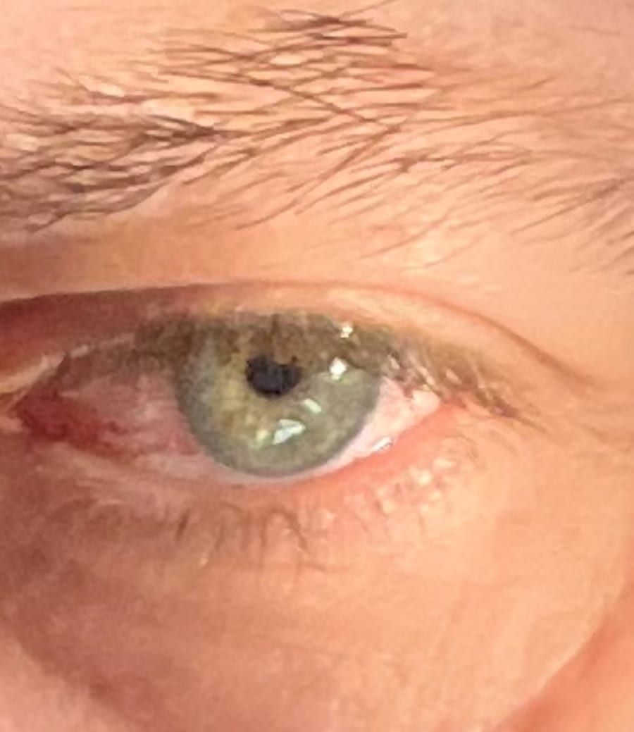 Profil de Eimen